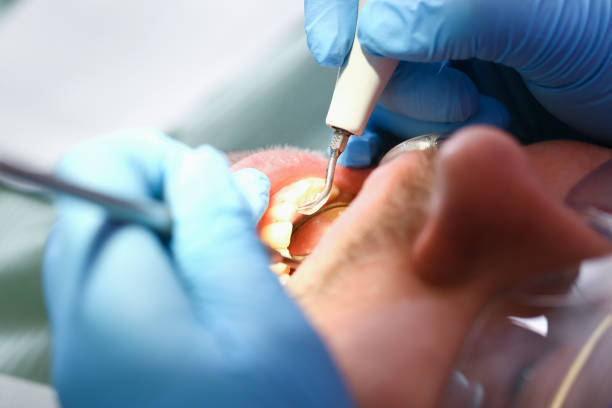 Best Urgent Care for Lost Fillings or Crowns in Navarre, FL