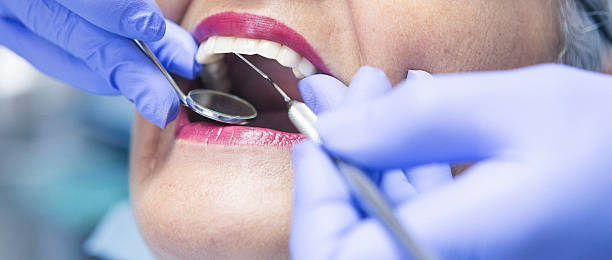 Best Emergency Treatment for Dental Infections or Abscesses in Navarre, FL